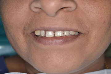 Vista Dental Care Patient Contouring