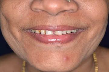 Vista Dental Care Patient Contouring