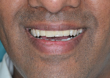 Vista Dental Care Patient