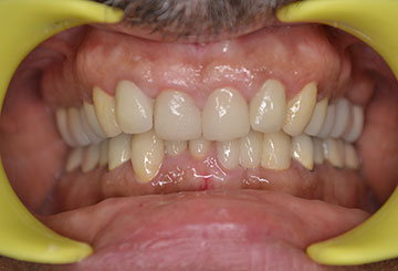 Vista Dental Care Patient